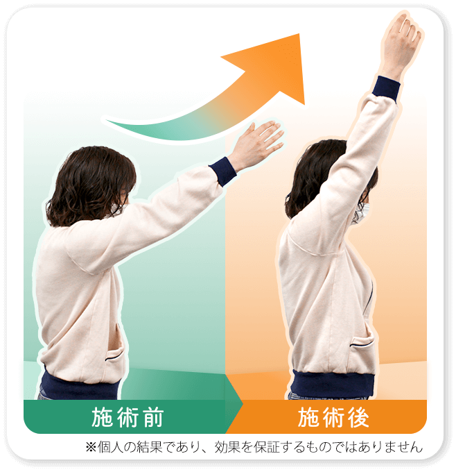 ビフォアアフター